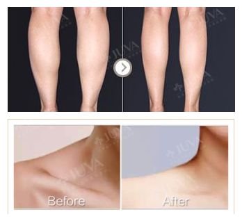 https://img.miyanlife.com/mnt/timg/180705/1224491311-4.jpg