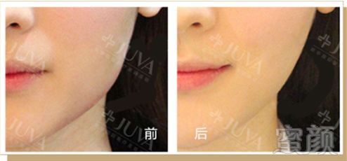 https://img.miyanlife.com/mnt/timg/180705/1224494P0-3.jpg