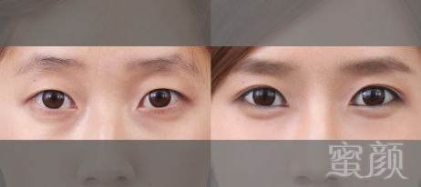 https://img.miyanlife.com/mnt/timg/180705/12553S264-2.jpg