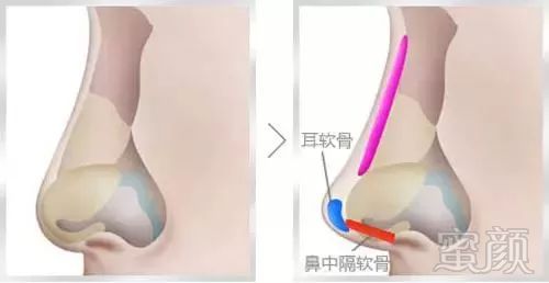 案例图片