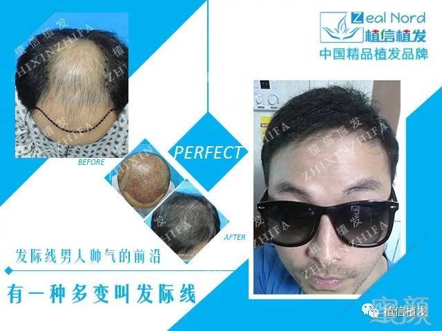 https://img.miyanlife.com/mnt/timg/180706/112554J52-5.jpg