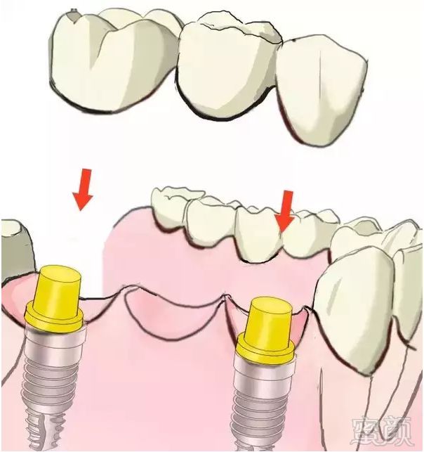https://img.miyanlife.com/mnt/timg/180706/1129101556-9.jpg