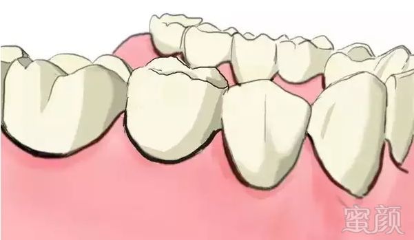 https://img.miyanlife.com/mnt/timg/180706/11291123X-10.jpg