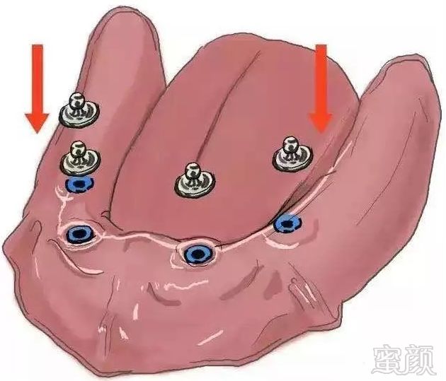 https://img.miyanlife.com/mnt/timg/180706/1129135D4-13.jpg