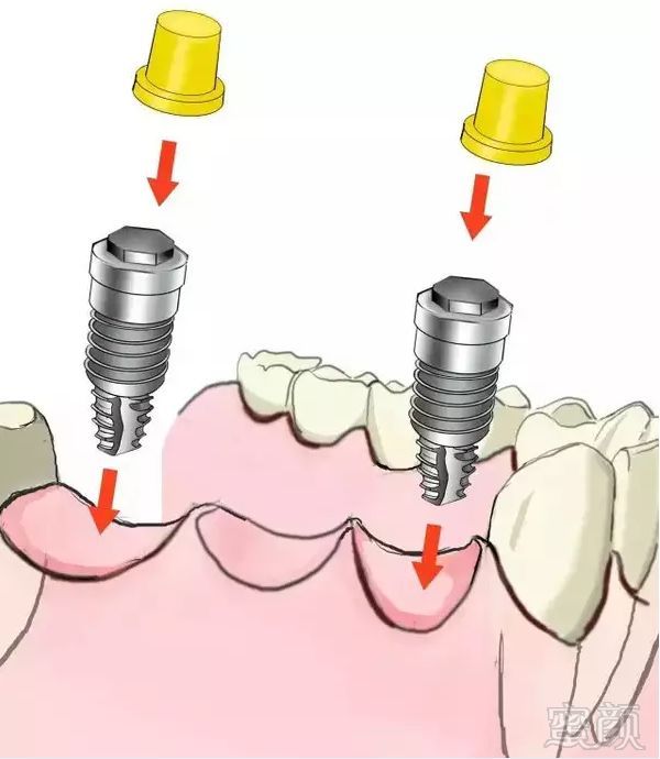 https://img.miyanlife.com/mnt/timg/180706/112Z91403-8.jpg