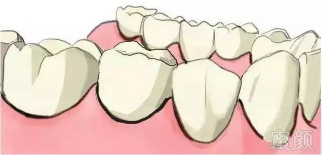 https://img.miyanlife.com/mnt/timg/180706/112ZM100-3.jpg