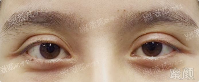 https://img.miyanlife.com/mnt/timg/180706/11304C145-0.jpg
