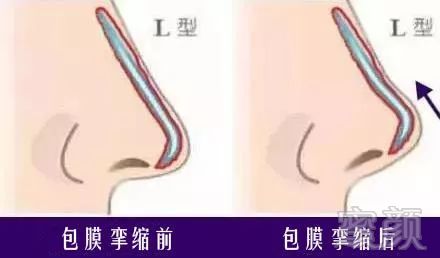https://img.miyanlife.com/mnt/timg/180706/11314552E-9.jpg