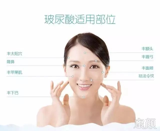 https://img.miyanlife.com/mnt/timg/180706/1141332116-0.jpg