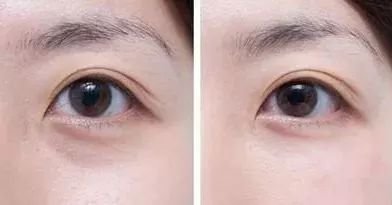 https://img.miyanlife.com/mnt/timg/180706/11413R604-7.jpg
