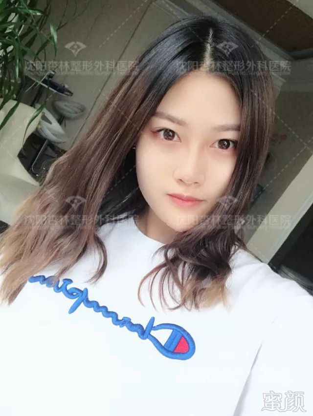 https://img.miyanlife.com/mnt/timg/180706/1144143510-4.jpg