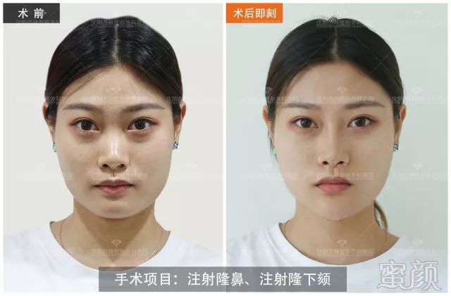 https://img.miyanlife.com/mnt/timg/180706/11441464X-5.jpg