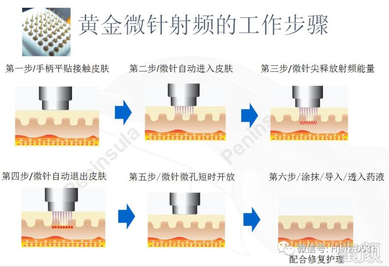 案例图片