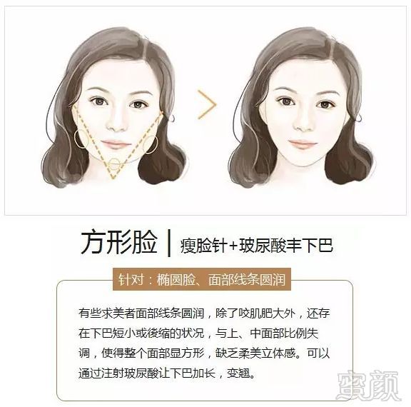 https://img.miyanlife.com/mnt/timg/180706/122600NN-2.jpg