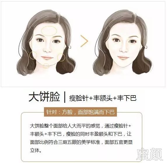https://img.miyanlife.com/mnt/timg/180706/122601O93-5.jpg