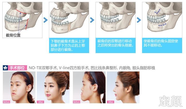 https://img.miyanlife.com/mnt/timg/180706/122913F95-2.jpg