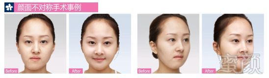 https://img.miyanlife.com/mnt/timg/180706/1229142425-6.jpg