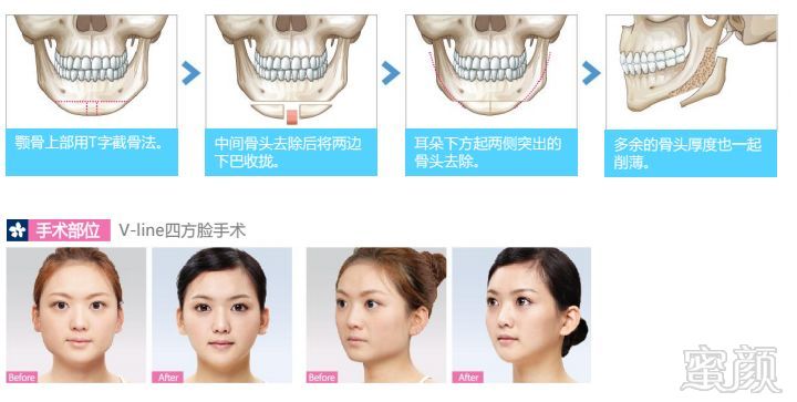 https://img.miyanlife.com/mnt/timg/180706/1229144532-12.jpg