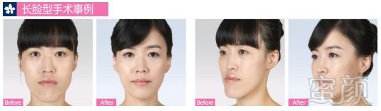 https://img.miyanlife.com/mnt/timg/180706/1229144549-8.jpg
