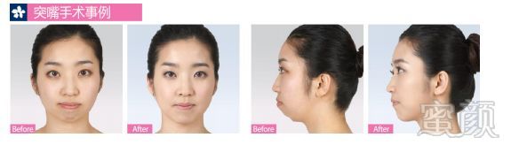 https://img.miyanlife.com/mnt/timg/180706/122914F49-10.jpg