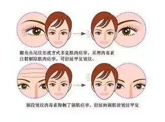 https://img.miyanlife.com/mnt/timg/180706/1245555403-5.jpg