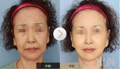 https://img.miyanlife.com/mnt/timg/180706/1251592594-5.jpg