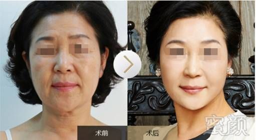 https://img.miyanlife.com/mnt/timg/180706/1251595233-6.jpg