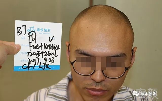 https://img.miyanlife.com/mnt/timg/180706/1306342G2-1.jpg