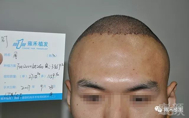 https://img.miyanlife.com/mnt/timg/180706/13063511J-6.jpg