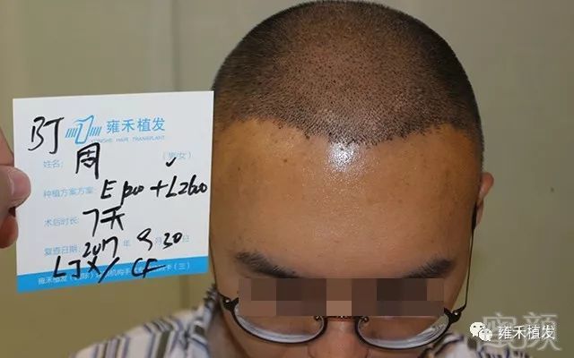 https://img.miyanlife.com/mnt/timg/180706/1306361110-8.jpg