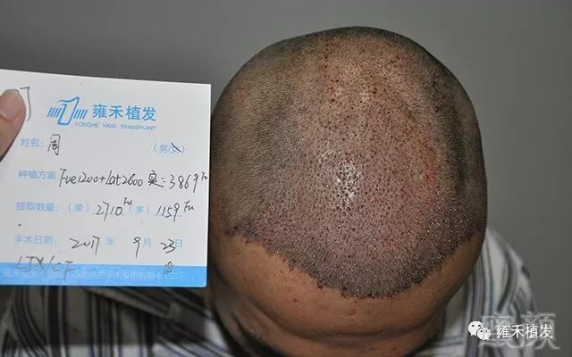 https://img.miyanlife.com/mnt/timg/180706/13063631U-7.jpg