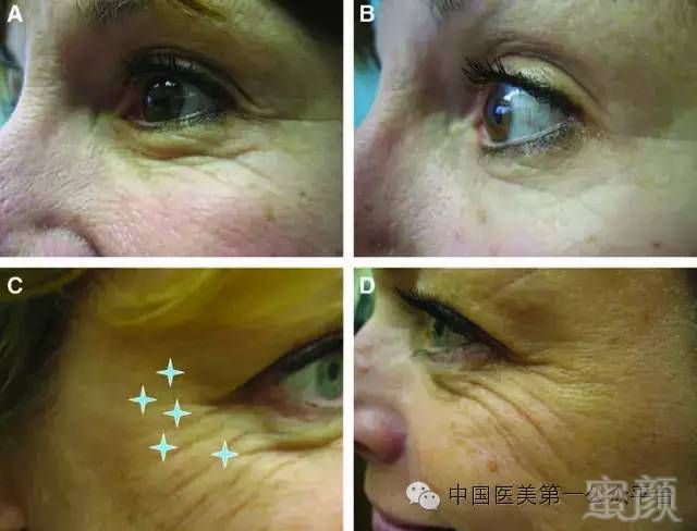 https://img.miyanlife.com/mnt/timg/180706/130R43V8-1.jpg