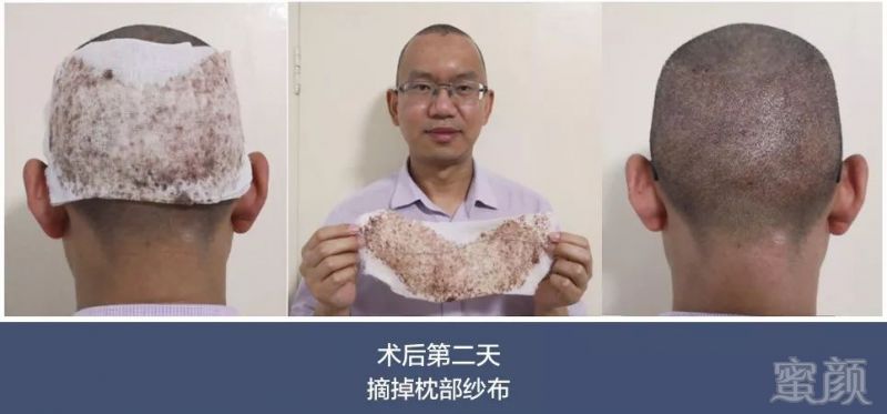 https://img.miyanlife.com/mnt/timg/180706/1310161C2-1.jpg