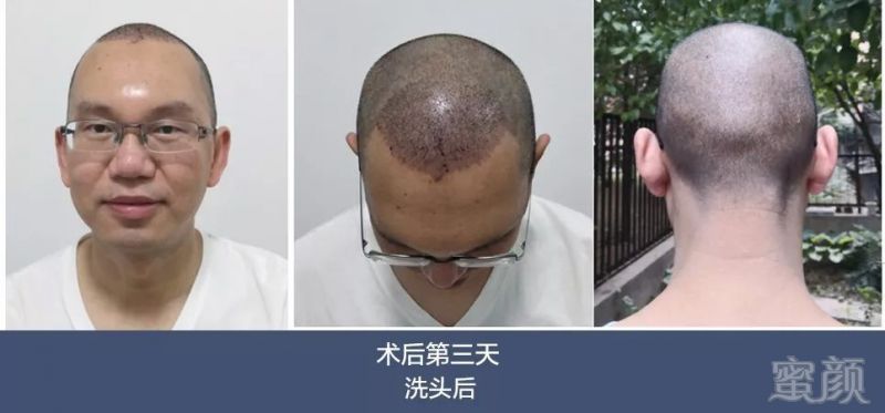 https://img.miyanlife.com/mnt/timg/180706/13102115D-2.jpg