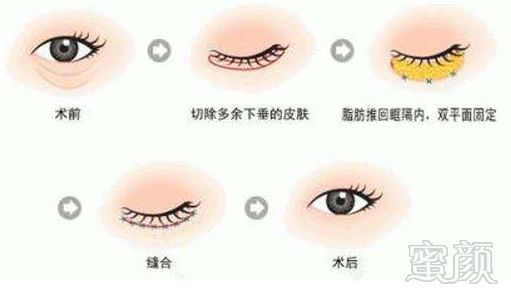 https://img.miyanlife.com/mnt/timg/180706/13204923H-6.jpg