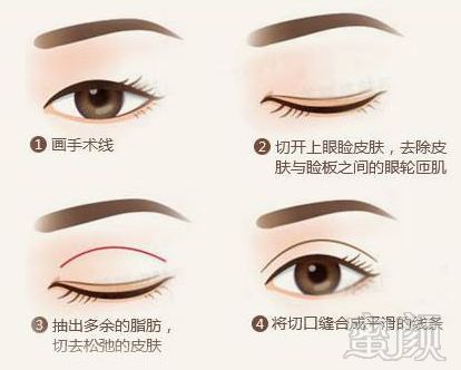 https://img.miyanlife.com/mnt/timg/180706/13204U515-1.jpg