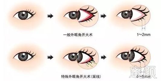 https://img.miyanlife.com/mnt/timg/180706/13204W4L-3.jpg