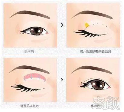 https://img.miyanlife.com/mnt/timg/180706/13204a251-4.jpg