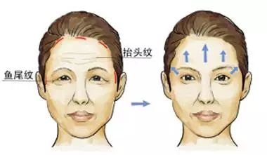 https://img.miyanlife.com/mnt/timg/180707/115F06142-5.jpg