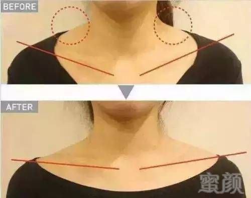 https://img.miyanlife.com/mnt/timg/180707/115R011I-15.jpg