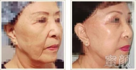 https://img.miyanlife.com/mnt/timg/180707/1205162263-2.jpg