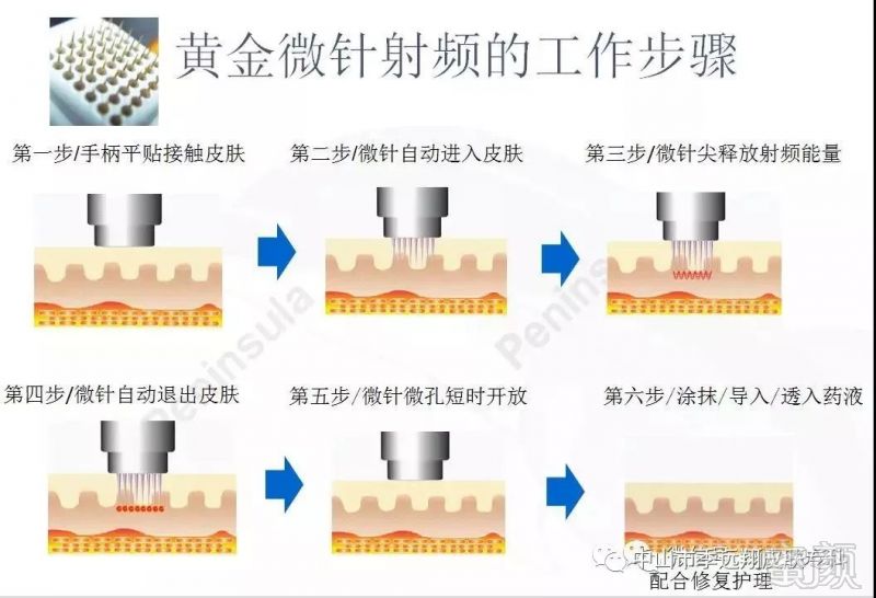 案例图片