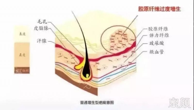 案例图片