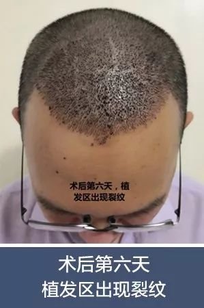https://img.miyanlife.com/mnt/timg/180707/1245411A4-2.jpg