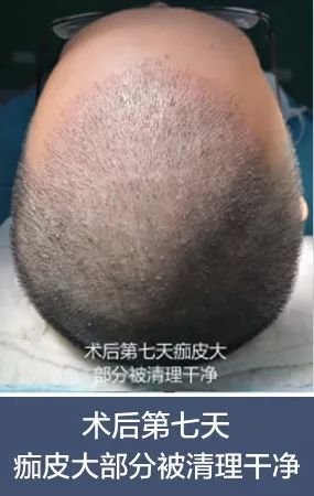 https://img.miyanlife.com/mnt/timg/180707/1245414311-3.jpg