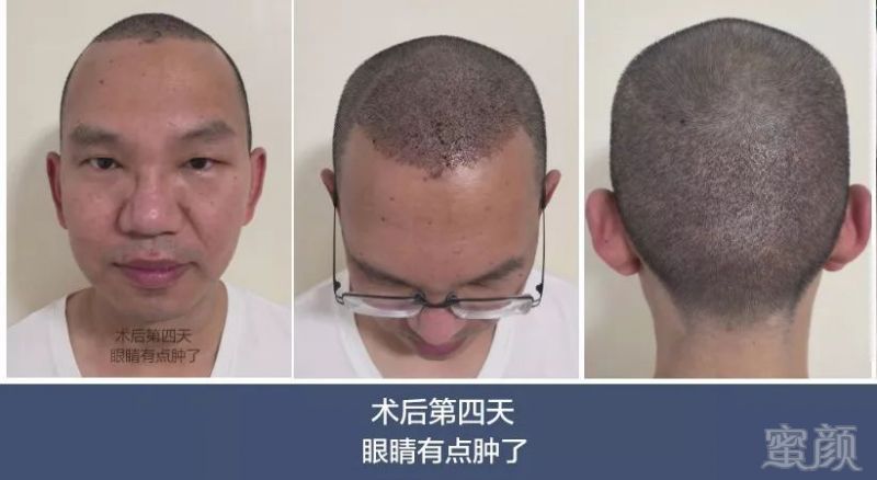 https://img.miyanlife.com/mnt/timg/180707/12454154C-0.jpg