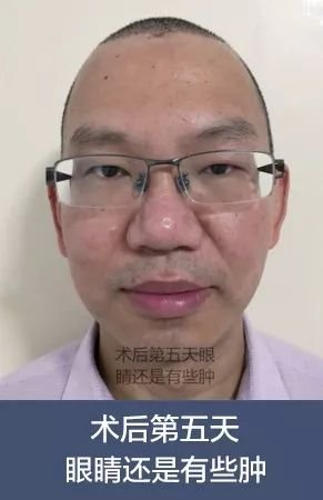 https://img.miyanlife.com/mnt/timg/180707/124541LA-1.jpg