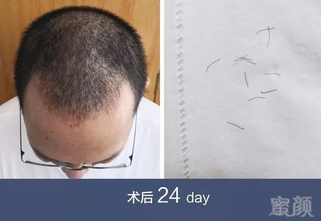 https://img.miyanlife.com/mnt/timg/180707/1245423229-6.jpg