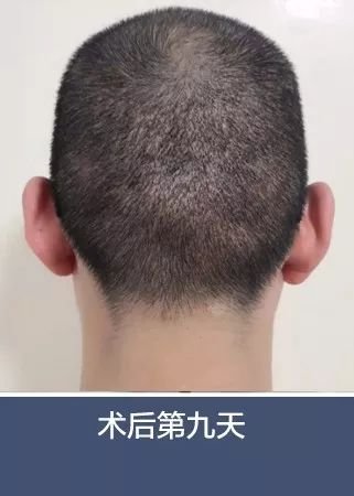 https://img.miyanlife.com/mnt/timg/180707/124542G61-4.jpg
