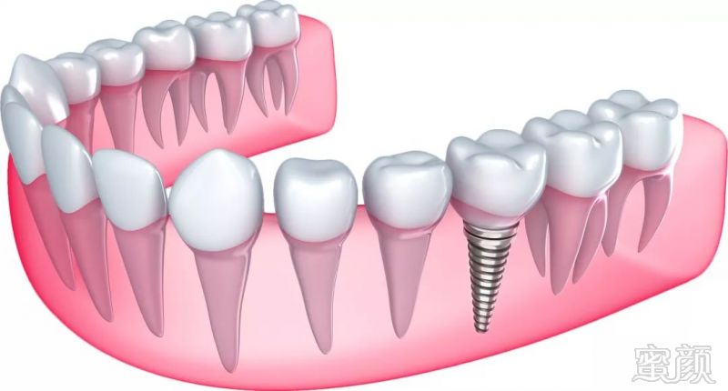https://img.miyanlife.com/mnt/timg/180707/1339494D6-2.jpg